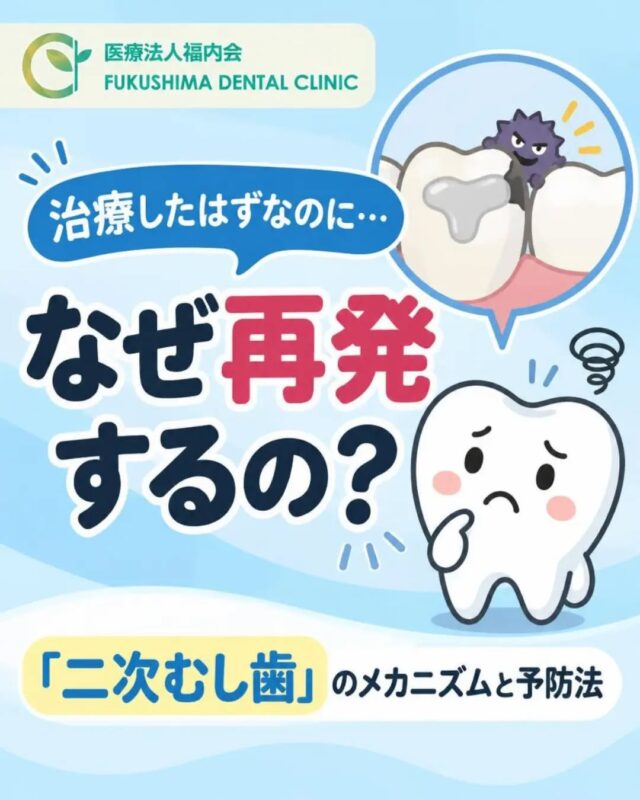 こんにちは！愛知県清須市にある「ふくしま歯科」です。

「以前、虫歯治療をして被せ物をした歯が、また痛む…」
「詰め物をしていたところが取れて、中を見たらまた虫歯になっていた…」

そんな経験をしたことはありませんか？

「一度歯医者さんでキレイに治療したから、もうこの歯は安心！」と思ってしまいがちですが、実は一度治療した歯であっても、再び虫歯になってしまうことがあります。
このように、過去に治療した歯に再度発生する虫歯のことを【二次むし歯（二次クラリス）】と呼びます。

大人の虫歯治療の多くが、実はこの「二次むし歯のやり直し治療」だと言われているほど、とても頻度の高いトラブルです。

今回は、二次むし歯が起こるメカニズムと、大切な歯を守るための予防法について詳しく解説します！

🔍 なぜ一度治した歯が「二次むし歯」になるの？
虫歯治療では、感染した部分を削り取り、その穴を補うために「詰め物（インレー）」や「被せ物（クラウン）」を装着します。

しかし、どんなに精度の高い治療を行っても、人工物である詰め物と、天然の歯との間には【微小な境目（継ぎ目）】が存在します。

この境目に食べかすや歯垢（プラーク）が溜まると、プラークの中に潜む虫歯菌が酸を作り出し、詰め物の下の歯をじわじわと溶かし始めてしまうのです。

さらに、人工の詰め物や接着剤は、毎日噛む力や温度変化、年月の経過によって少しずつ摩耗したり劣化したりします。劣化によって境目に小さな段差や目に見えない隙間ができると、より一層汚れが溜まりやすくなり、二次むし歯のリスクが高まってしまいます。

🚨 気づきにくいのが「二次むし歯」の恐ろしさ
二次むし歯の最も厄介な点は、初期段階で自覚症状がほとんどないことです。

歯の表面が金属やセラミック、プラスチックで覆われているため、外側から見ても内部で虫歯が進んでいることに気づけません。また、過去の治療で神経を抜いている歯の場合、内部でどんなに虫歯が進行していても痛みを感じないため、発見が遅れやすくなります。

「詰め物が急に外れた」「詰め物の周りが黒ずんできた」「冷たいものがしみる」「噛んだときに違和感がある」といった症状がある場合は、内部で二次むし歯が進行している可能性があるため、早めのチェックが必要です。

💡 二次むし歯を防ぐための予防ポイント
二次むし歯を防ぎ、治療した歯を長持ちさせるためには、毎日のセルフケアとプロによる管理が不可欠です。

◆ 境目を意識した丁寧なブラッシング
歯と歯ぐきの境目だけでなく、「歯と詰め物の境目」を意識して歯ブラシを当てましょう。力を入れすぎず、小刻みに優しく磨くのがコツです。

◆ デンタルフロス・歯間ブラシの併用
歯と歯の間に詰め物がある場合、歯ブラシだけでは約6割の汚れしか落とせません。フロスや歯間ブラシを毎日使うことで、境目のプラークを徹底的に除去しましょう。

◆ フッ素配合のハミガキ粉を使う
フッ素には、歯の再石灰化を促し、酸に強い歯質を作る働きがあります。毎日の歯磨きにフッ素を取り入れることで、詰め物の周囲の歯を補強できます。

◆ 定期的な歯科検診を受ける
歯科医院での定期検診では、見た目ではわからない詰め物のズレや、初期の二次むし歯のサインをレントゲンや拡大鏡などでチェックできます。問題が小さいうちに早期発見できれば、歯を削る量を最小限に抑えることができます。

✨ まとめ：「治療が終わった後」こそケアの始まりです
二次むし歯は、決して特別な人にだけ起こるものではありません。
「治療が終わったから完成！」ではなく、「治療が終わったからこそ、ここから丁寧に守っていこう！」という意識が、一生モノの自分の歯を残すための第一歩です。

ふくしま歯科では、むし歯の治療はもちろん、治療後の再発を防ぐための予防ケアやブラッシング指導、定期メンテナンスに力を入れています。

「昔治療した歯がなんとなく気になる」「長らく歯医者さんに行っていないな」という方は、ぜひお気軽に当院までお越しくださいね。

#ふくしま歯科
#清須市歯医者
#二次むし歯
#むし歯予防
#予防歯科